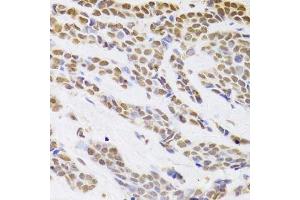 Immunohistochemistry (Paraffin-embedded Sections) (IHC (p)) image for anti-Hepatoma-Derived Growth Factor (HDGF) (AA 1-240) antibody (ABIN6141694)