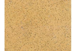 ABIN6265289 and ABIN6273076 at 1/100 staining Mouse brain tissue by IHC-P. (SRP68 Antikörper  (C-Term))