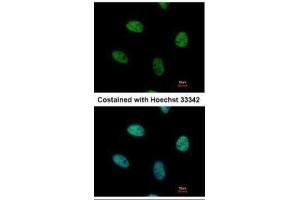 ICC/IF Image Immunofluorescence analysis of paraformaldehyde-fixed HeLa, using NUR77, antibody at 1:500 dilution. (NR4A1 Antikörper  (C-Term))