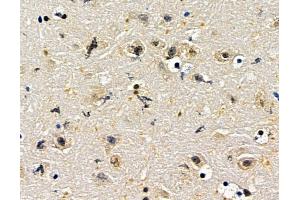 ABIN7096729 and ABIN7100794 at 1/100 staining mouse brain tissue by IHC-P. (ZNF382 Antikörper)