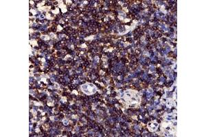 Immunohistochemistry of paraffin embedded human tonsil using CD3 (ABIN7073386) at dilution of 1: 1000 (400x lens)