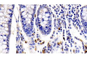 Immunohistochemistry (IHC) image for anti-Interleukin 22 Receptor, alpha 1 (IL22RA1) (AA 267-565) antibody (ABIN7439531)