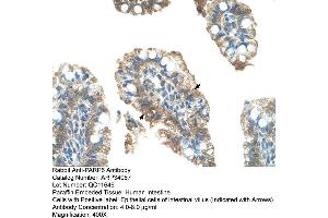 Human Intestine (PARP6 Antikörper  (C-Term))