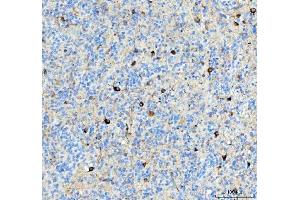 IHC analysis of Alpha Internexin using anti-Alpha Internexin antibody (ABIN4886634). (INA Antikörper  (AA 71-161))