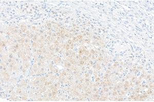 Immunohistochemistry (IHC) image for anti-Nicotinamide phosphoribosyltransferase (NAMPT) (AA 400-450) antibody (ABIN7454619)