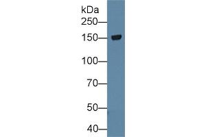 Western Blot; Sample: Rat Cerebrum lysate; Primary Ab: 1µg/ml Rabbit Anti-Rat TNR Antibody Second Ab: 0. (Tenascin R Antikörper  (AA 329-588))