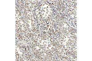 IHC analysis of SNRNP40 using anti-SNRNP40 antibody (ABIN7601719). (SNRNP40 Antikörper  (AA 43-357))