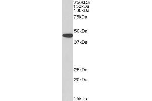 ABIN2613380 (0. (AMACR Antikörper  (AA 312-326))