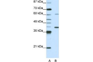 WB Suggested Anti-MGC46336 Antibody Titration:  0.