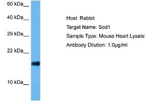 Host: Mouse Target Name: SOD1 Sample Tissue: Mouse Heart Antibody Dilution: 1ug/ml (SOD1 Antikörper  (C-Term))