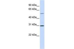 Image no. 1 for anti-NIMA related kinase 3 (NEK3) (AA 108-157) antibody (ABIN6741054) (NEK3 Antikörper  (AA 108-157))