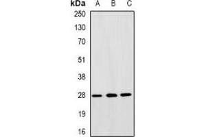 Western blot analysis of TFIIF RAP 30 expression in SW480 (A), HepG2 (B), A549 (C) whole cell lysates. (GTF2F2 Antikörper)