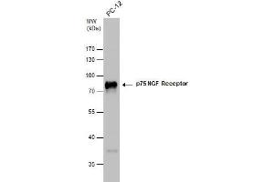 WB Image p75 NGF Receptor antibody detects p75 NGF Receptor protein by western blot analysis. (NGFR Antikörper)