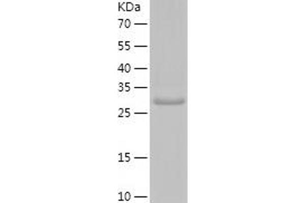 PLG Protein (AA 98-356) (His tag)