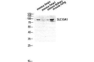 Western Blotting (WB) image for anti-Solute Carrier Family 15 (Oligopeptide Transporter), Member 1 (SLC15A1) (Internal Region) antibody (ABIN3176831) (SLC15A1 Antikörper  (Internal Region))