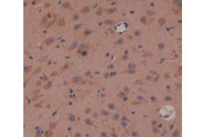 IHC-P analysis of brain tissue, with DAB staining. (Oligophrenin 1 Antikörper  (AA 634-802))