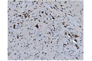 IHC analysis of MAPK1 using anti-MAPK1 antibody (ABIN7600772). (MAPK11 Antikörper  (AA 230-364))