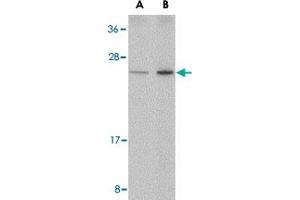 Western blot analysis of DDIT4 in human kidney tissue lysate with DDIT4 polyclonal antibody  at (A) 0. (DDIT4 Antikörper  (Internal Region))