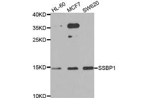 Western blot analysis of extracts of various cell lines, using SSBP1 antibody (ABIN5974202) at 1/1000 dilution. (SSBP1 Antikörper)