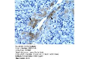 Rabbit Anti-GATA3 Antibody  Paraffin Embedded Tissue: Human Liver Cellular Data: Hepatocyte Antibody Concentration: 4. (GATA3 Antikörper  (C-Term))