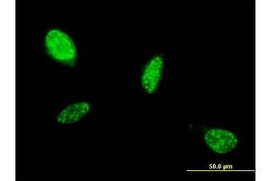 Immunofluorescence of monoclonal antibody to ATOH1 on HeLa cell. (ATOH1 Antikörper  (AA 266-354))