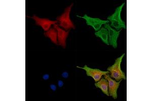 ABIN6261584 and ABIN6278325 staining Hela cells by IF/ICC.