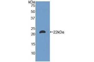 Detection of Recombinant LAMa1, Mouse using Polyclonal Antibody to Laminin Alpha 1 (LAMA1) (Laminin alpha 1 Antikörper  (AA 2640-2773))