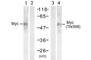 Western blot analysis of extracts from HT-29 cells treated with UV (20min), using Myc (Ab-358) antibody (E021035, Lane 1 and 2) and Myc (phospho-Thr358) antibody (E011035, Lane 3 and 4). (c-MYC Antikörper  (pThr358))