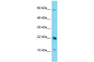 Host: Rabbit Target Name: C17orf105 Sample Type: HepG2 Whole Cell lysates Antibody Dilution: 1. (C17ORF105 Antikörper  (Middle Region))