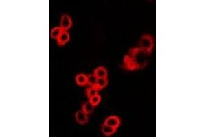 Immunofluorescent analysis of MALT1 staining in U2OS cells. (MALT1 Antikörper)