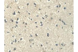 Detection of ALDH1A2 in Human Cerebrum Tissue using Polyclonal Antibody to Aldehyde Dehydrogenase 1 Family, Member A2 (ALDH1A2)