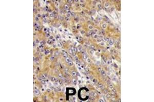 Immunohistochemistry (IHC) image for anti-Myosin ID (MYO1D) antibody (ABIN3002631)