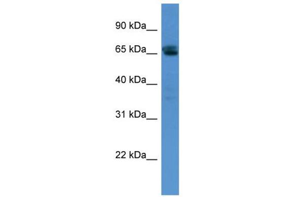 SMARCD3 Antikörper  (N-Term)