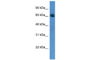 WB Suggested Anti-SMARCD3 Antibody Titration:  0. (SMARCD3 Antikörper  (N-Term))