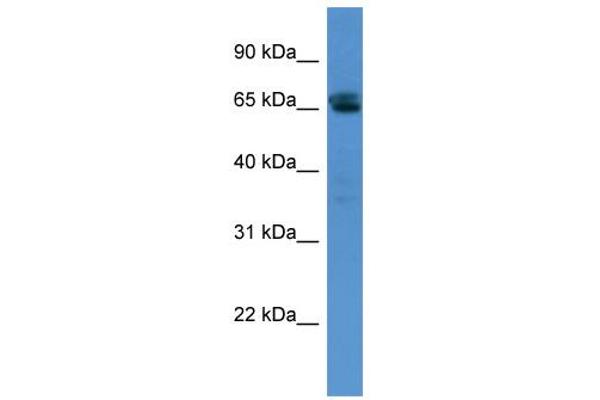SMARCD3 抗体  (N-Term)