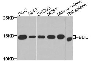 Western blot analysis of extracts of various cell lines, using BLID antibody. (BLID Antikörper)