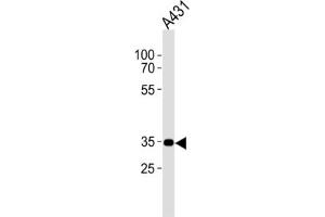 Western Blotting (WB) image for anti-Cannabinoid Receptor 2 (CNR2) antibody (ABIN2995770) (CNR2 Antikörper)
