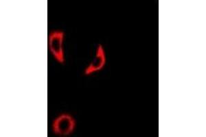 Immunofluorescent analysis of IL-18BP staining in A549 cells. (IL18BP Antikörper)