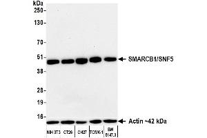 Western Blotting (WB) image for anti-SWI/SNF Related, Matrix Associated, Actin Dependent Regulator of Chromatin, Subfamily B, Member 1 (SMARCB1) (AA 100-150) antibody (ABIN7795715)