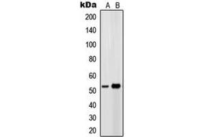 Western blot analysis of EP4 expression in Ramos (A), HeLa (B) whole cell lysates. (PTGER4 Antikörper  (Center))
