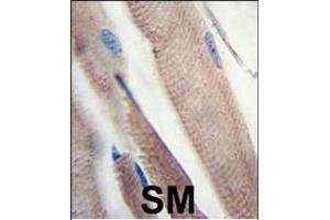 Formalin-fixed and paraffin-embedded human skeletal muscle tissue reacted with PI3KC3 Antibody , which was peroxidase-conjugated to the secondary antibody, followed by DAB staining. (PIK3C3 Antikörper  (AA 831-856))