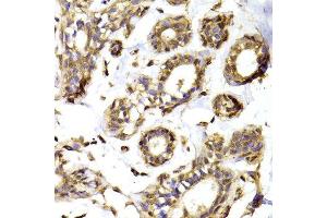 Immunohistochemistry of paraffin-embedded Human mammary gland using RPL13 antibody at dilution of 1:100 (x400 lens).
