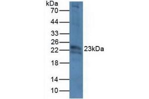 Detection of CRYbB2 in Mouse Eye Tissue using Polyclonal Antibody to Crystallin Beta B2 (CRYbB2)