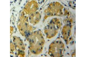 Used in DAB staining on fromalin fixed paraffin-embedded Stomach tissue (ADAMTS12 Antikörper  (AA 823-997))