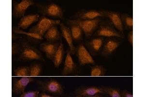 Immunofluorescence (IF) image for anti-Protein Phosphatase 2, Regulatory Subunit B', delta (PPP2R5D) antibody (ABIN7258604)