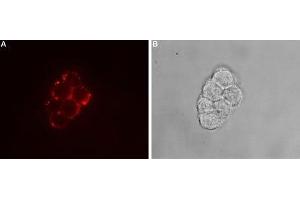 Expression of TRPC7 in rat PC12 cells - Cell surface detection of TRPC7 in intact living rat pheochromocytoma (PC12) cells using. (TRPC7 Antikörper  (2nd Extracellular Loop))