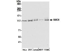 Western Blotting (WB) image for anti-SMC6 Structural Maintenance of Chromosomes 6-Like 1 (SMC6) (C-Term) antibody (ABIN7454597) (SMC6 Antikörper  (C-Term))