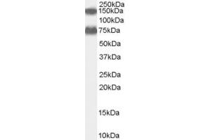 Western Blotting (WB) image for anti-Acyl-CoA Oxidase 2, Branched Chain (Acox2) (AA 325-336) antibody (ABIN290470) (Acox2 Antikörper  (AA 325-336))