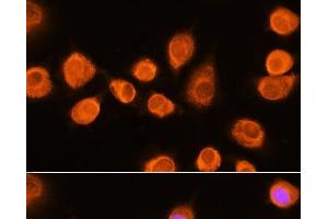 Immunofluorescence analysis of L929 cells using ASPM Polyclonal Antibody at dilution of 1:100.