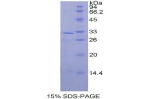 SDS-PAGE analysis of Human MAPK9 Protein. (JNK2 Protein)